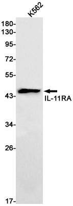 1 - IL-11RA Rabbit mAb AP75610