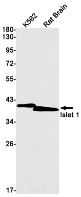 1 - Islet 1 Rabbit mAb AP75634
