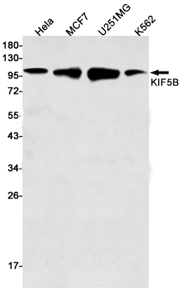 2 - KIF5B Rabbit mAb AP75653