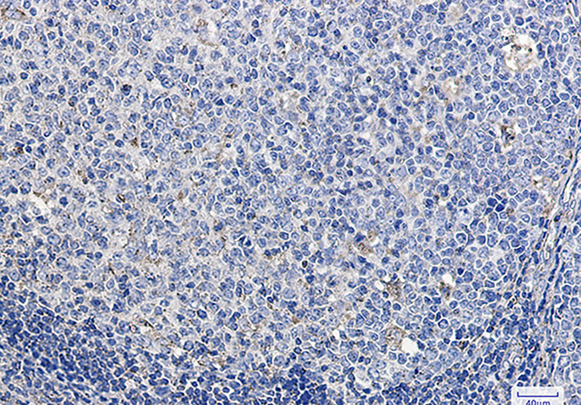 2 - LAMP1 Rabbit mAb AP75665