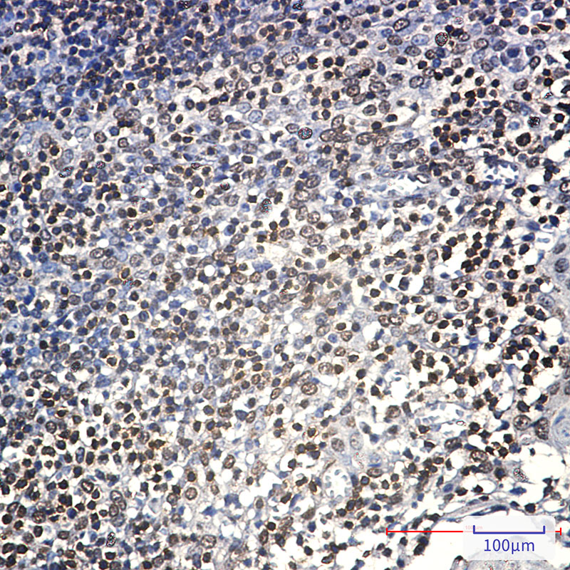 5 - Lck Rabbit mAb AP75669