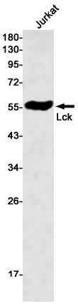 3 - Lck Rabbit mAb AP75669