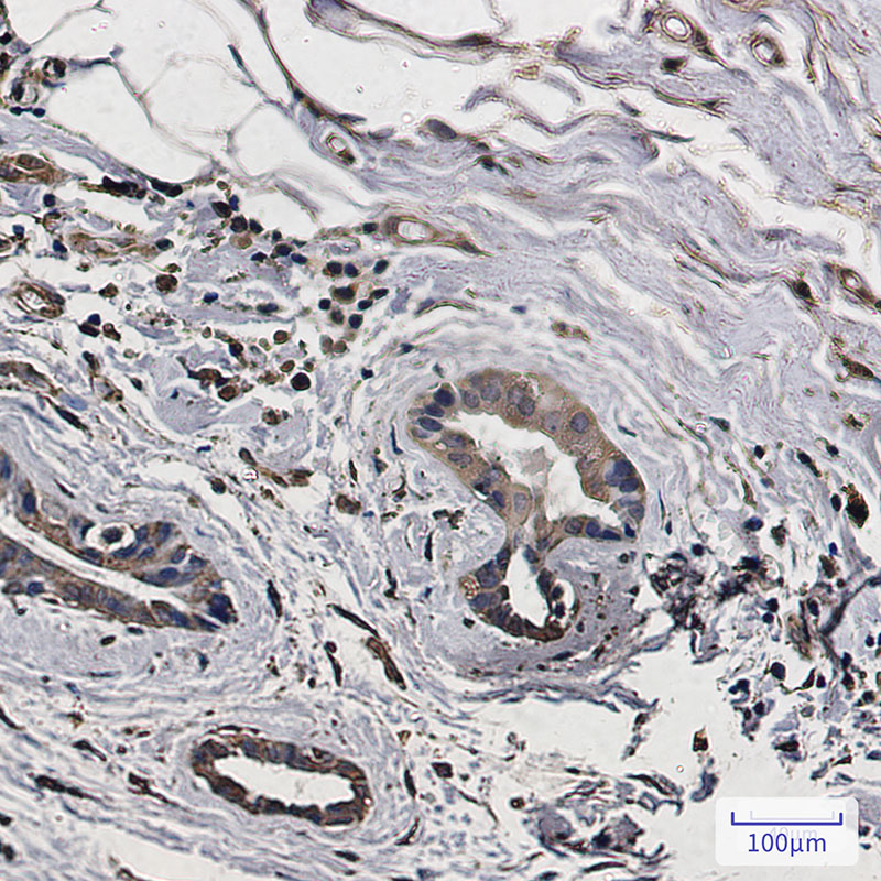 4 - LC3A Rabbit mAb AP75690