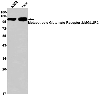 2 - Metabotropic Glutamate Receptor 2 Rabbit mAb AP75713