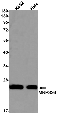 1 - MRPS26 Rabbit mAb AP75737