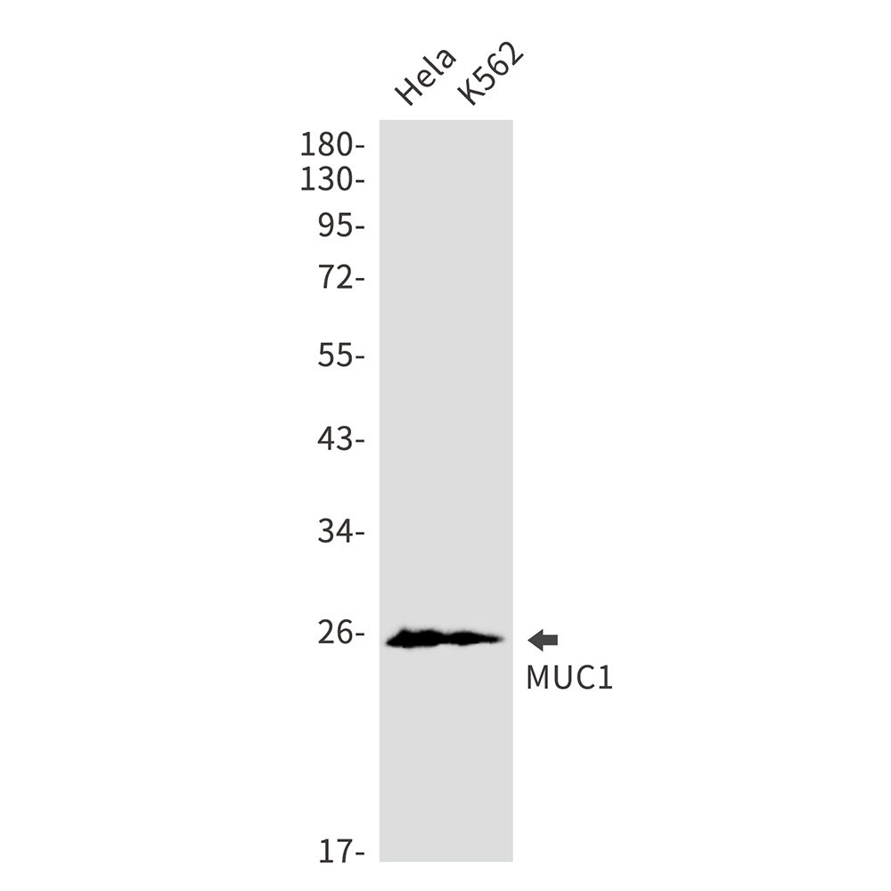 1 - MUC1 Rabbit mAb AP75753