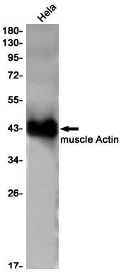 2 - ACTA1 Rabbit mAb AP75756