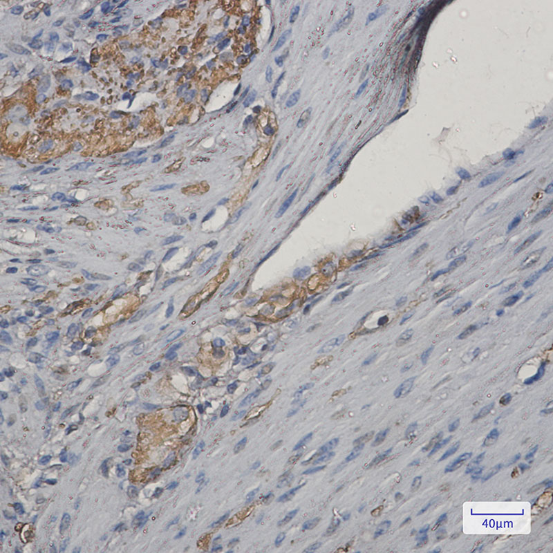 4 - NEK9 Rabbit mAb AP75794