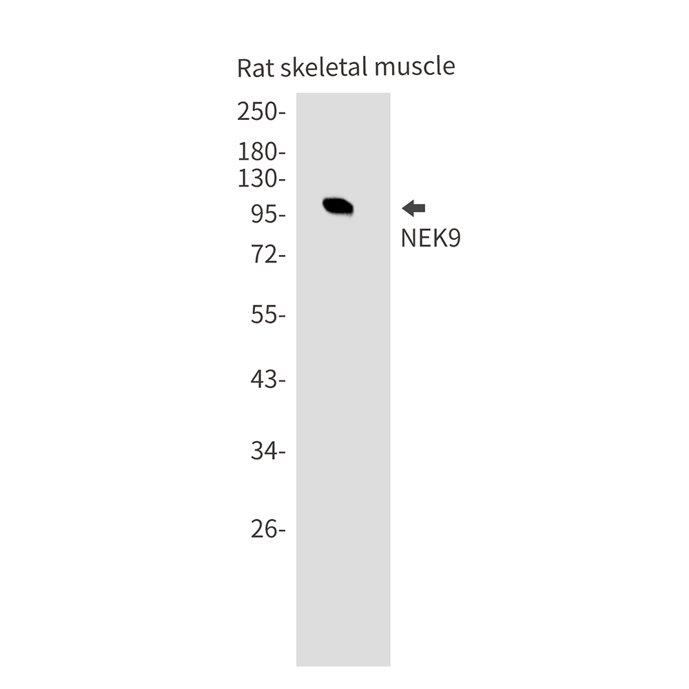 2 - NEK9 Rabbit mAb AP75794
