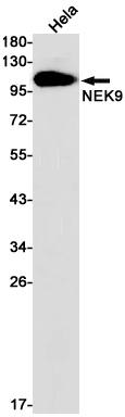 8 - NEK9 Rabbit mAb AP75794