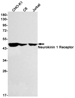 5 - Neurokinin 1 Receptor Rabbit mAb AP75802