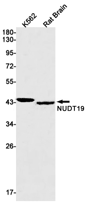 2 - NUDT19 Rabbit mAb AP75830