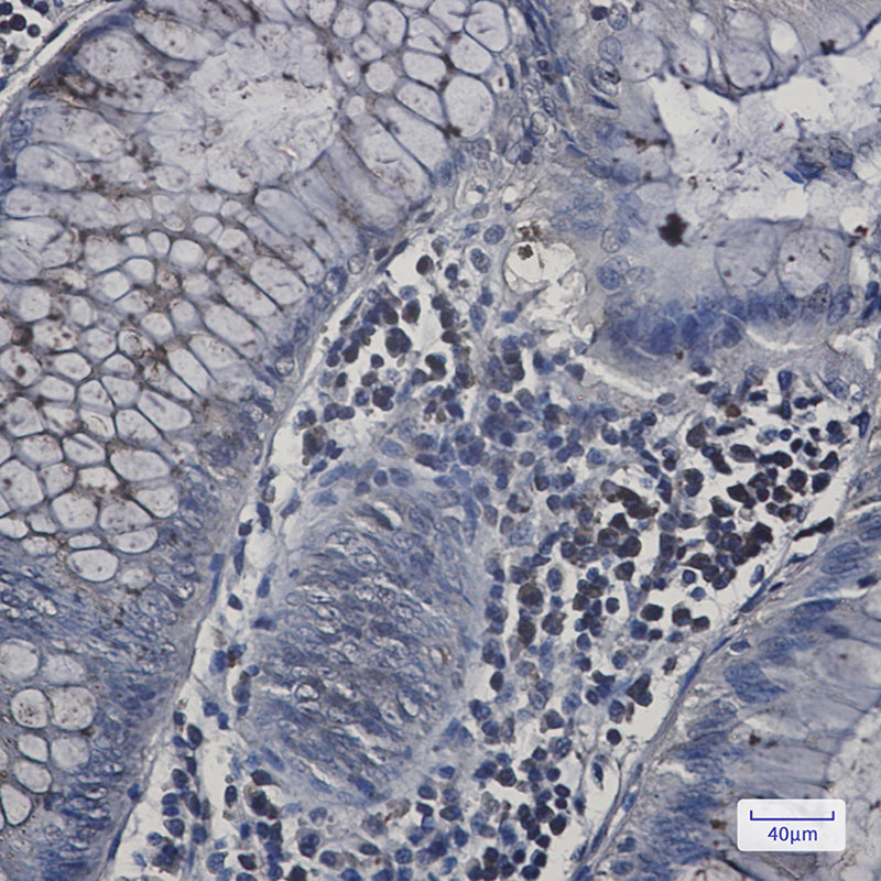 2 - N WASP Rabbit mAb AP75836