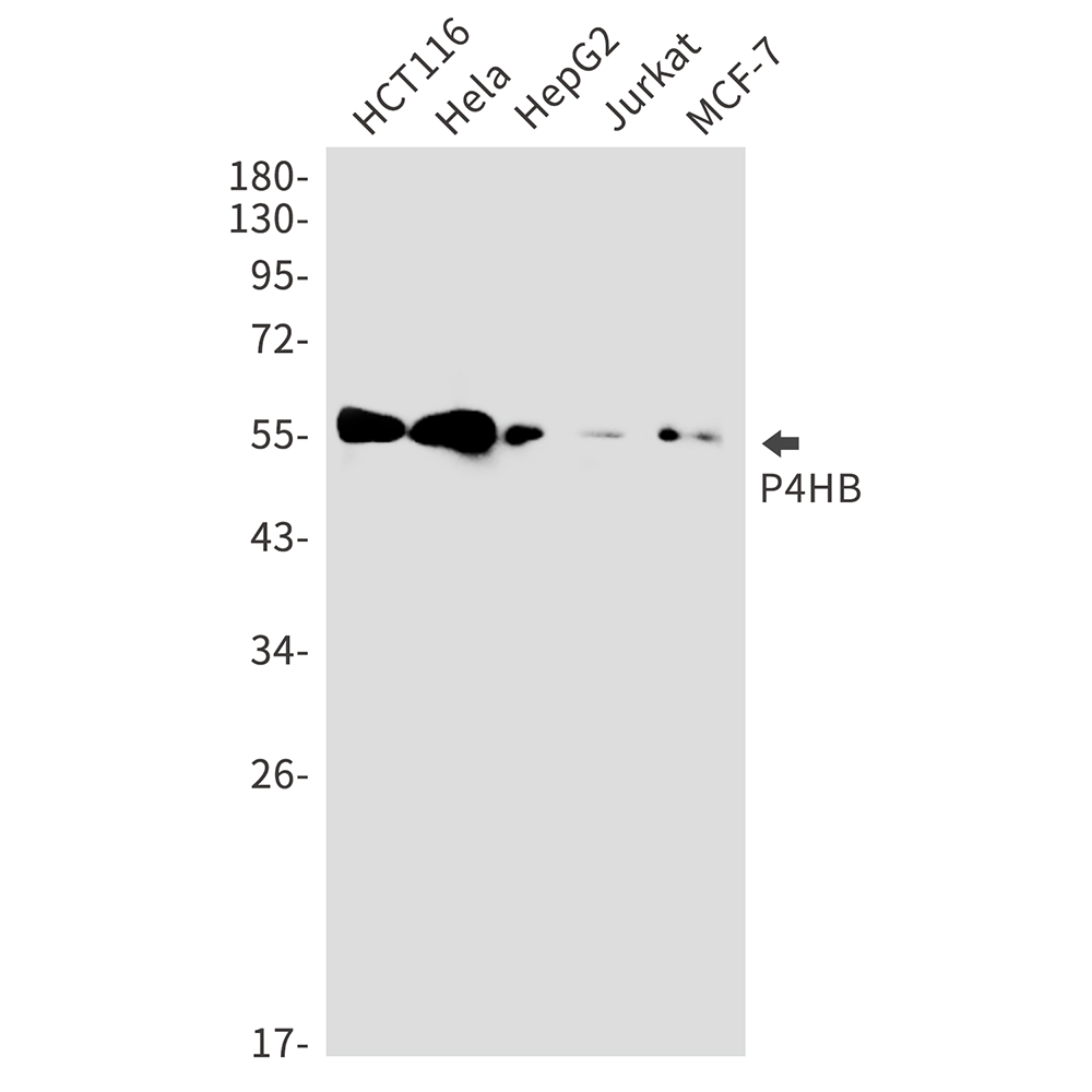 1 - P4HB Rabbit mAb AP75853