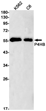 1 - P4HB Rabbit mAb AP75854