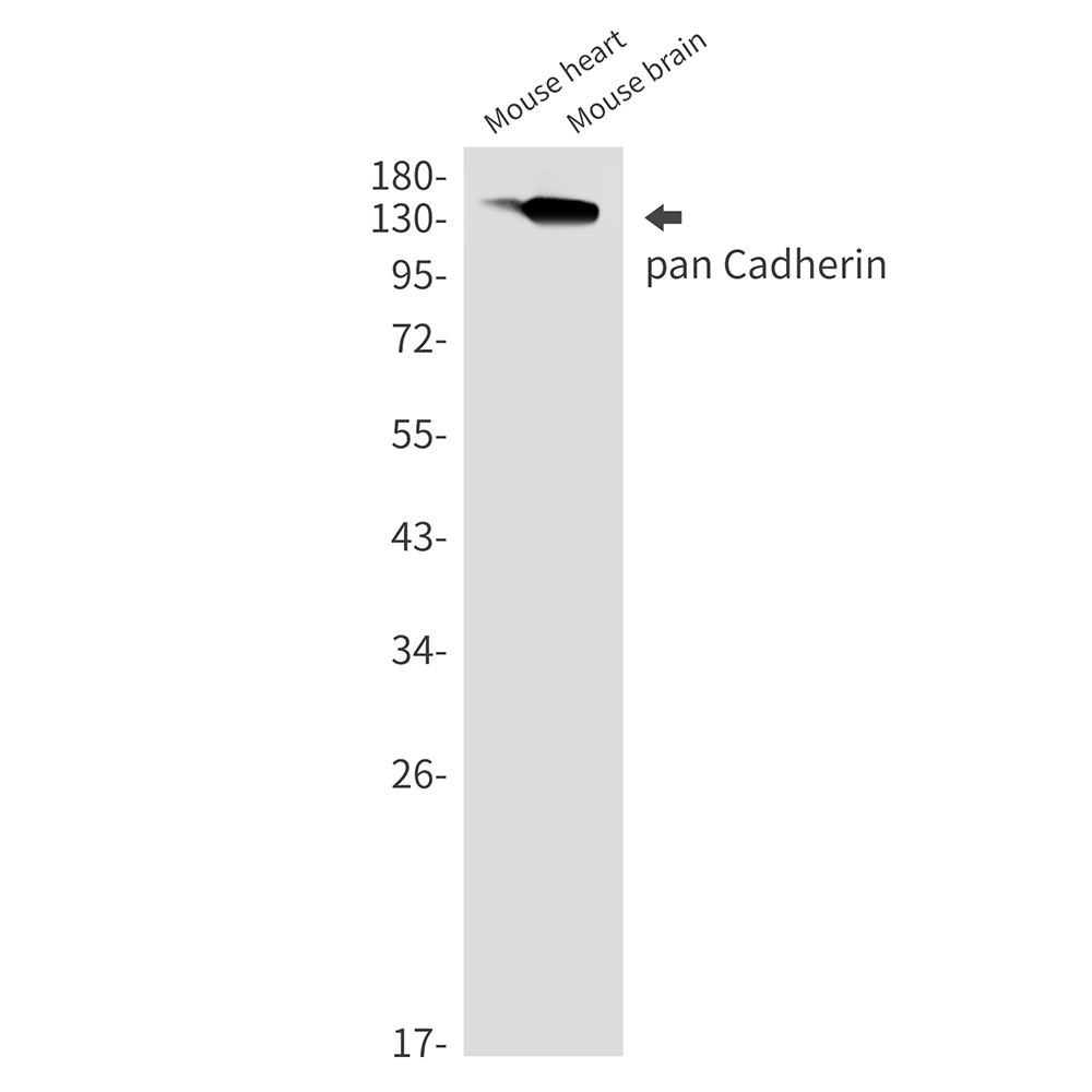 1 - P cadherin Rabbit mAb AP75869