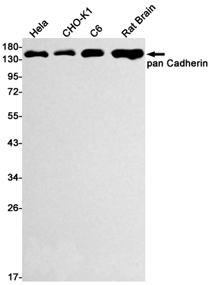 2 - P cadherin Rabbit mAb AP75869