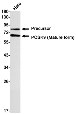 1 - PCSK9 Rabbit mAb AP75878
