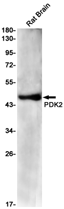 1 - PDK2 Rabbit mAb AP75884
