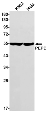 1 - PEPD Rabbit mAb AP75891