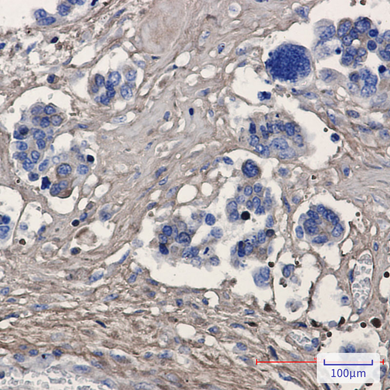 2 - Periostin Rabbit mAb AP75892