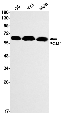 1 - PGM1 Rabbit mAb AP75901
