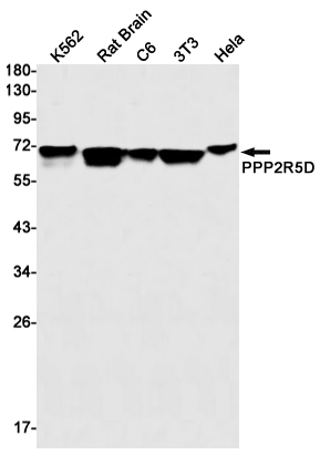 1 - PPP2R5D Rabbit mAb AP75941