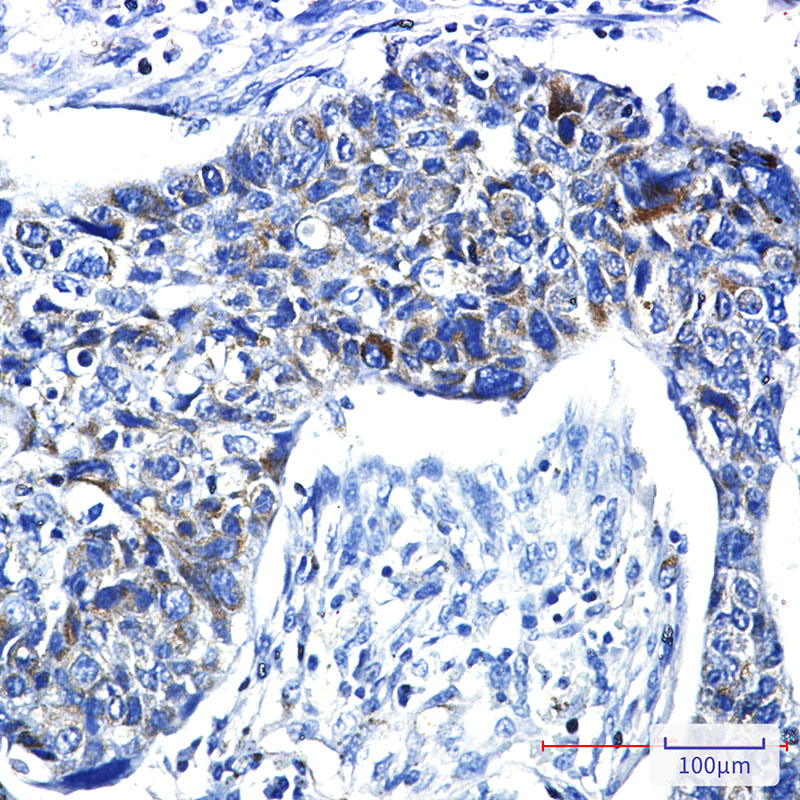 8 - PRC1 Rabbit mAb AP75945