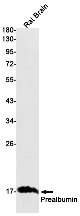1 - Prealbumin Rabbit mAb AP75946