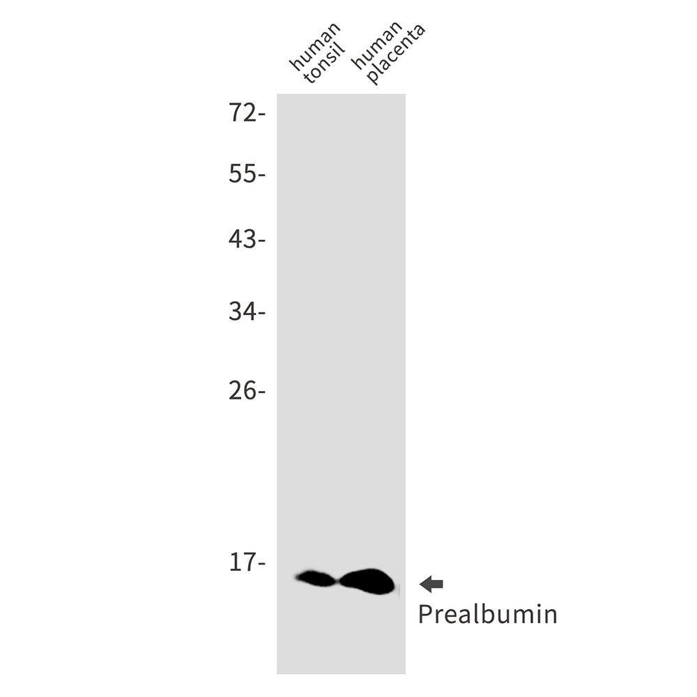 1 - Prealbumin Rabbit mAb AP75947
