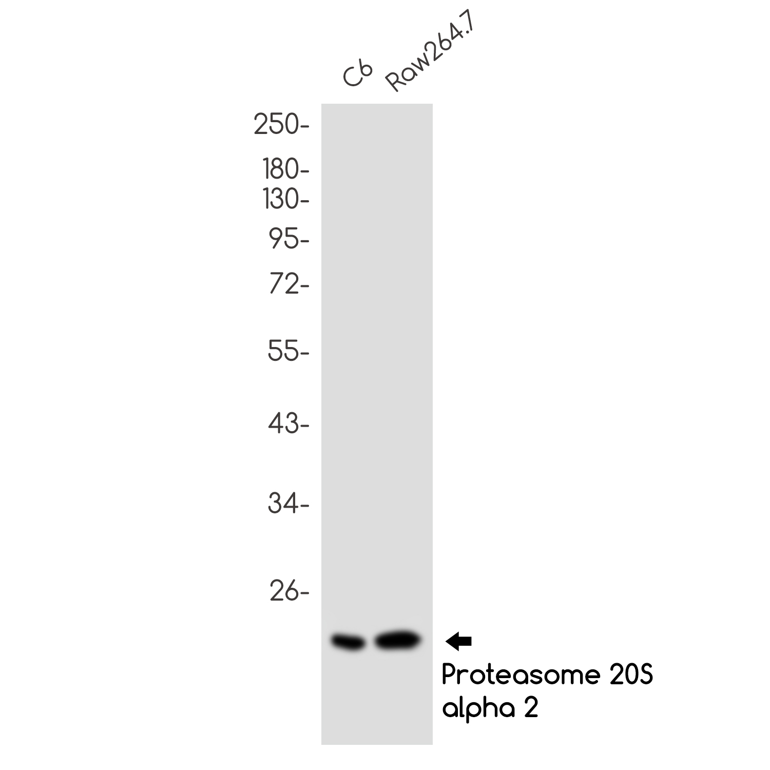 1 - PSMB9 Rabbit mAb AP75958