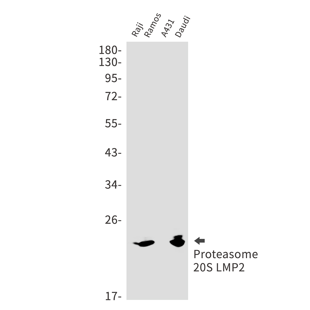 8 - PSMB9 Rabbit mAb AP75958