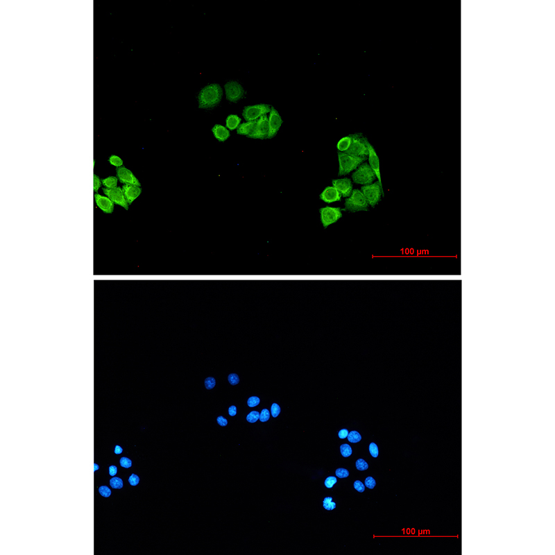 2 - Proteasome subunit alpha type 6 Rabbit mAb AP75959