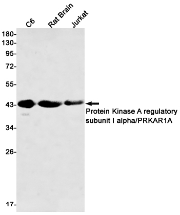 1 - PRKAR1A Rabbit mAb AP75960