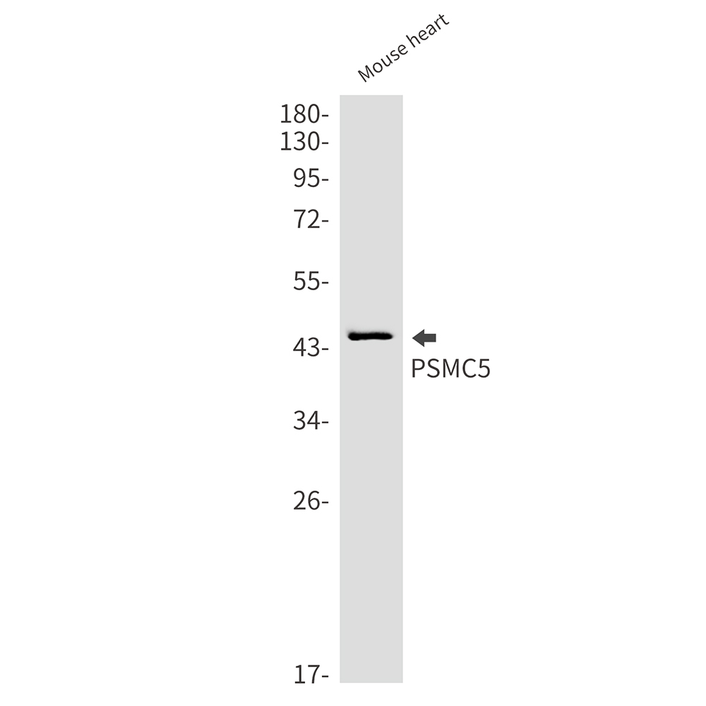 1 - PSMC5 Rabbit mAb AP75971