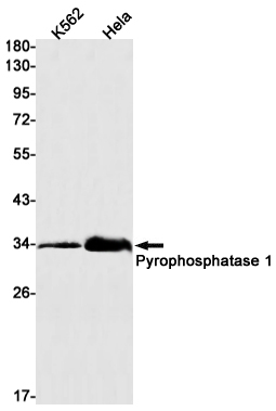 5 - Pyrophosphatase 1 Rabbit mAb AP75981