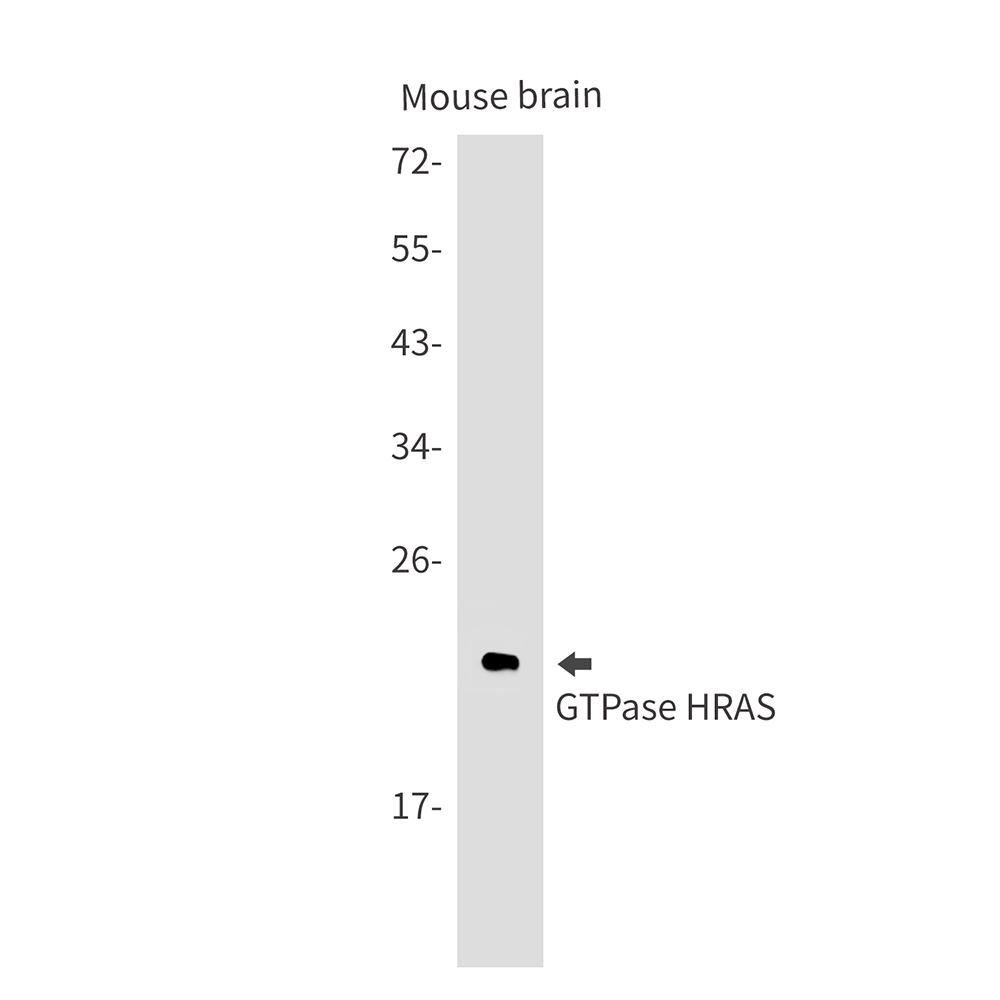 1 - GTPase HRAS Rabbit mAb AP76006