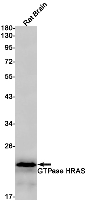 3 - GTPase HRAS Rabbit mAb AP76006