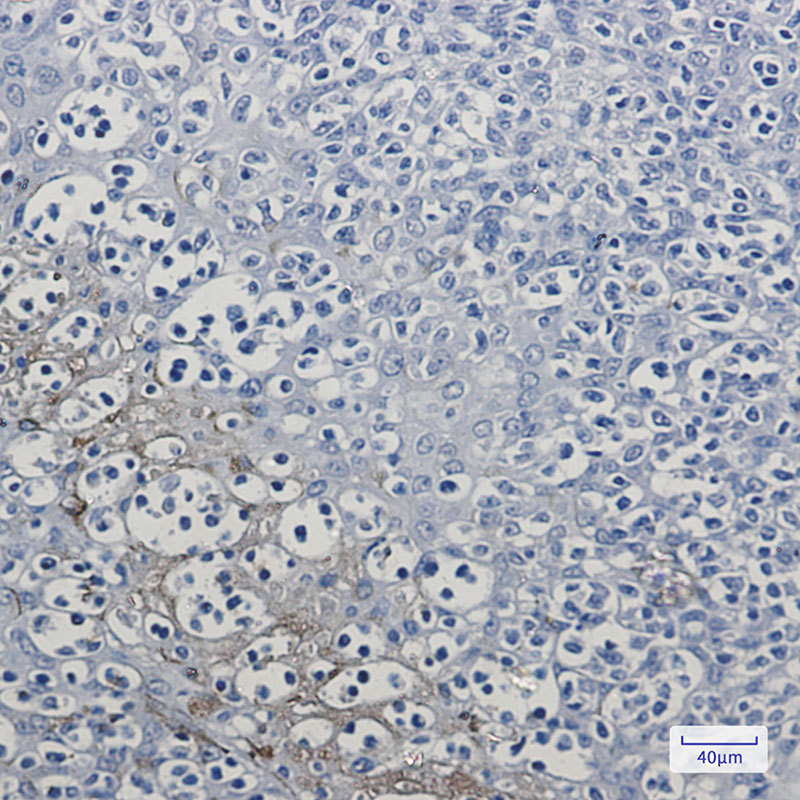 2 - RKIP Rabbit mAb AP76026