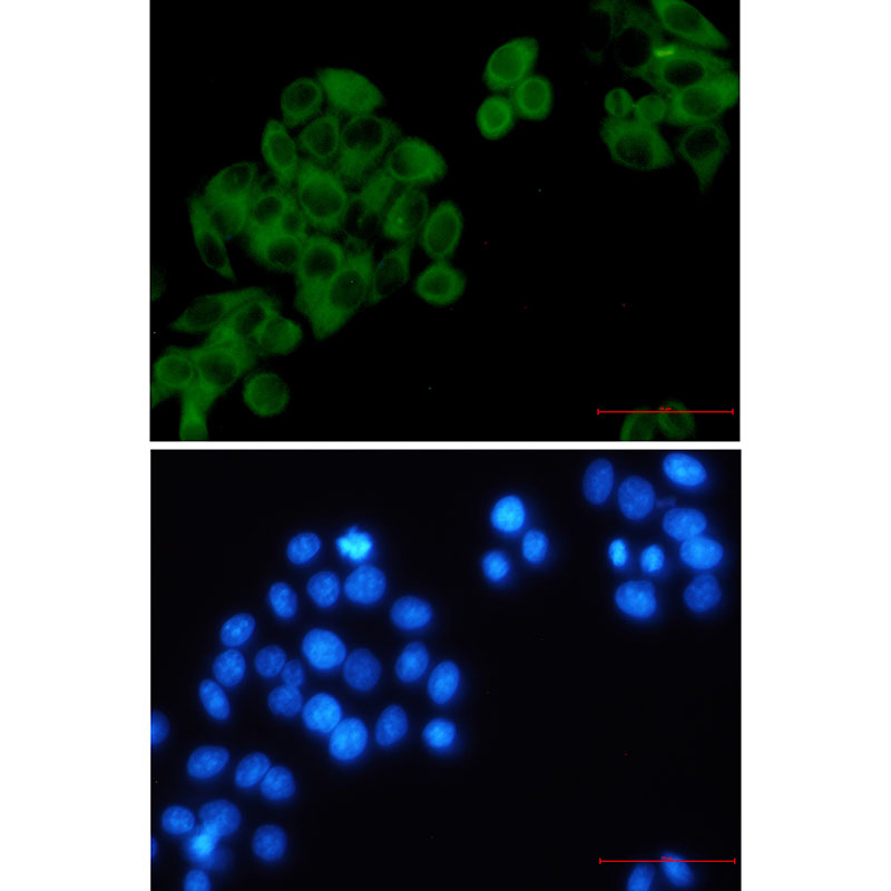 8 - RRM1 Rabbit mAb AP76037