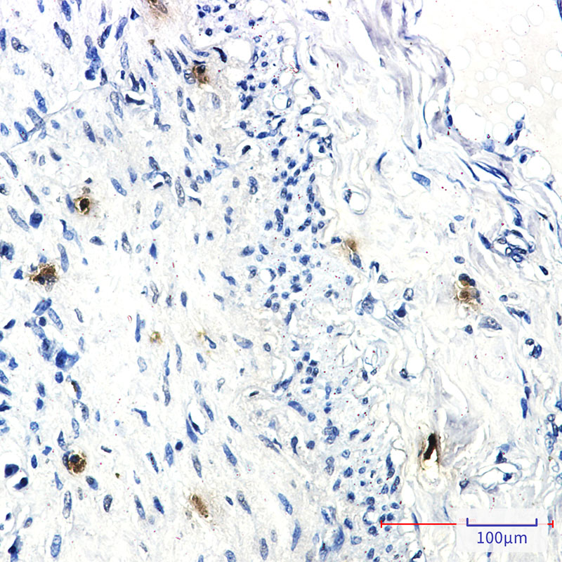 2 - RRM1 Rabbit mAb AP76037