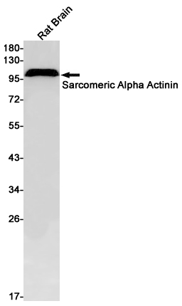 5 - Sarcomeric alpha Actinin Rabbit mAb AP76054