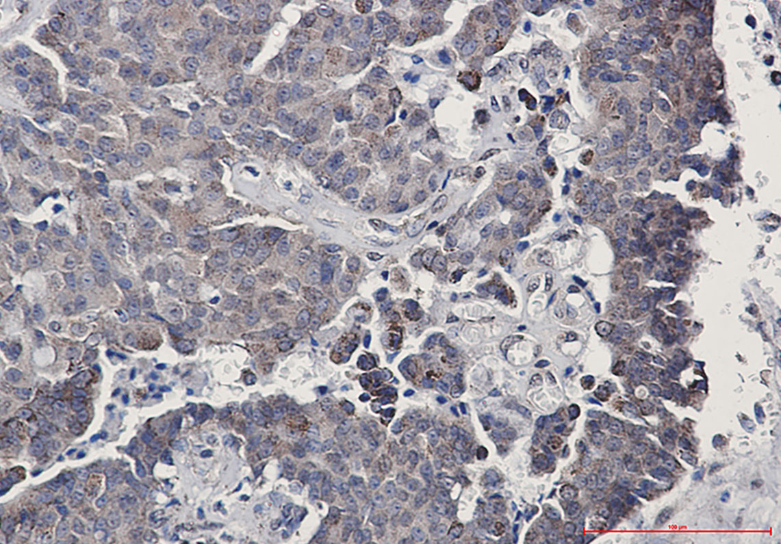 2 - SIRT3 Rabbit mAb AP76086