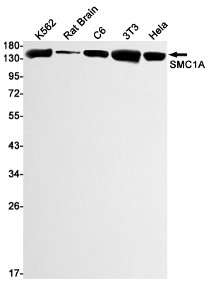 1 - SMC1A Rabbit mAb AP76098