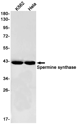 1 - Spermine Synthase Rabbit mAb AP76112
