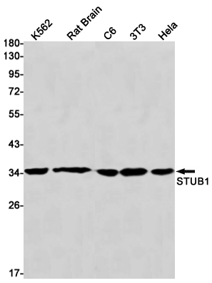 1 - STUB1 Rabbit mAb AP76132