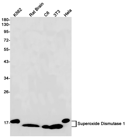 1 - Superoxide Dismutase 1 Rabbit mAb AP76136