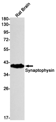 8 - Synaptophysin Rabbit mAb AP76139