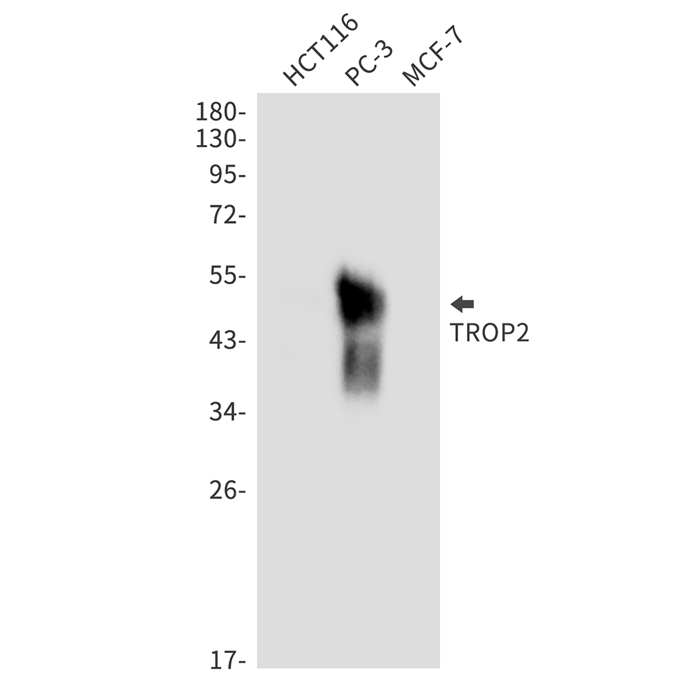 1 - TROP2 Rabbit mAb AP76145