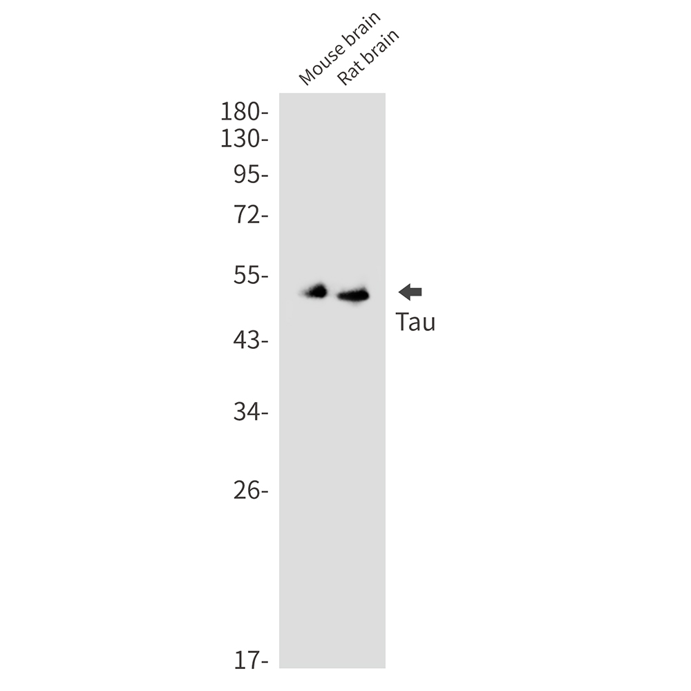 1 - Tau Rabbit mAb AP76154